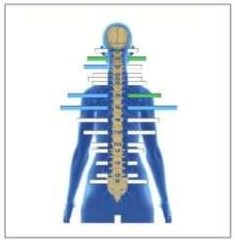 Neuro Spinal EMG report showing muscle energy levels at each level of the spine